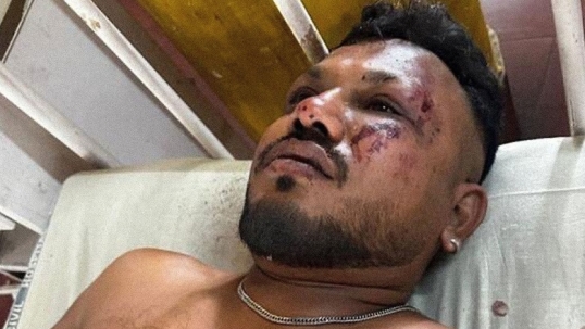 India: un sobreviviente del avión escuchó «un ruido fuerte»